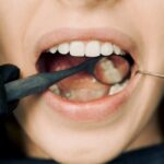 Close-up of a dental examination with modern equipment, showcasing oral hygiene maintenance.