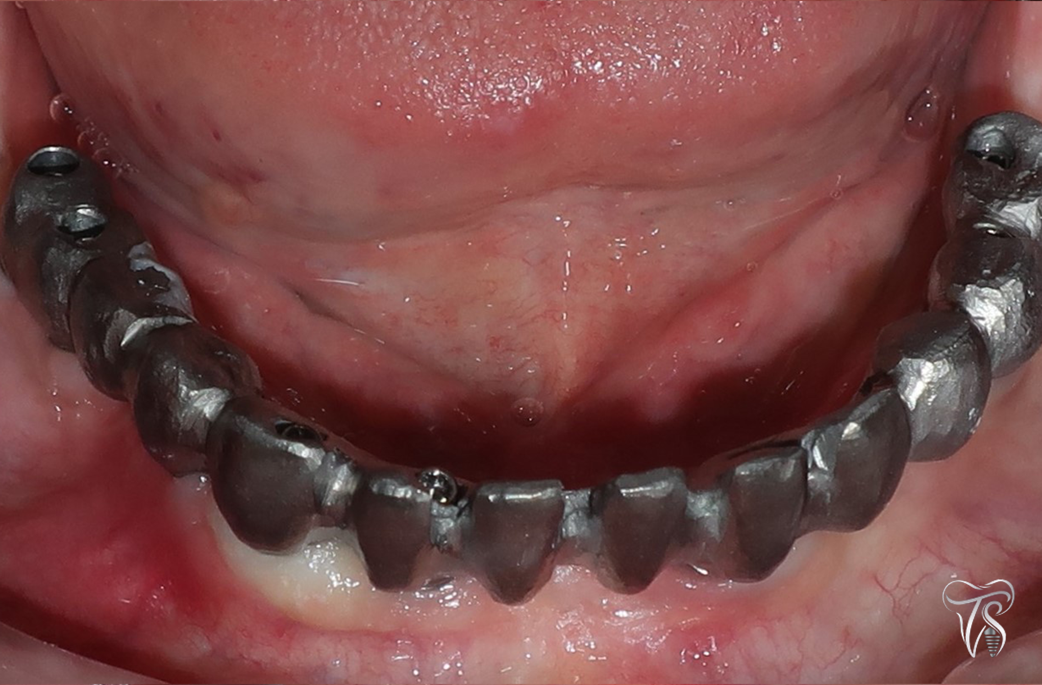 pic 11