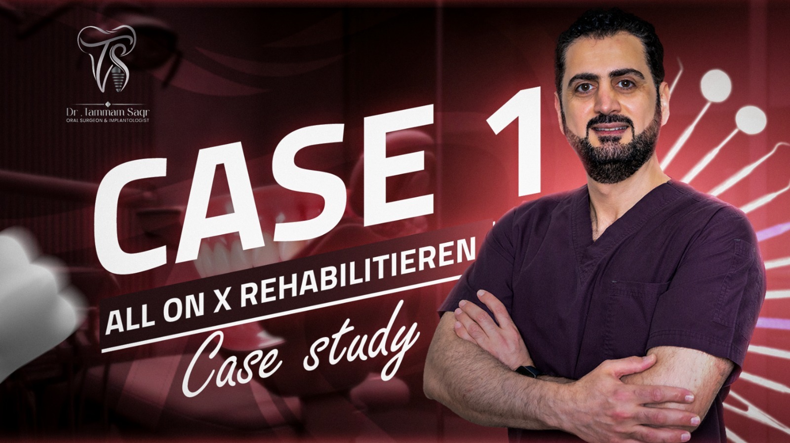 دراسة حالة All-on-X منشورة على الموقع الرئيسي للدكتور تمام صقر
